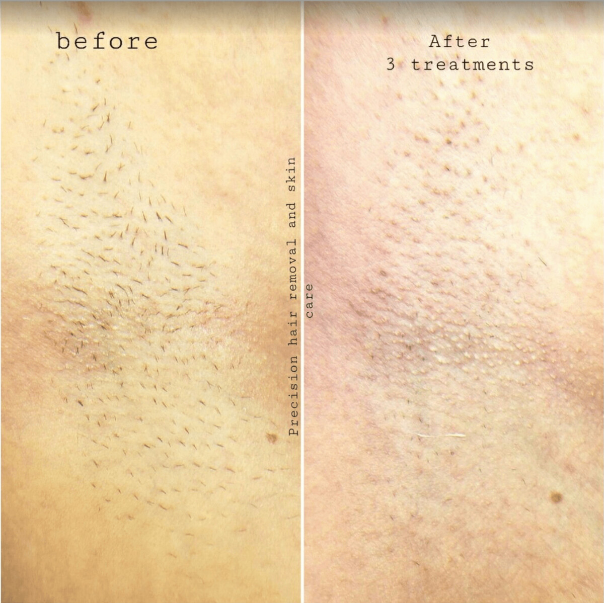 Images Cirine Hair Removal & Skin Care