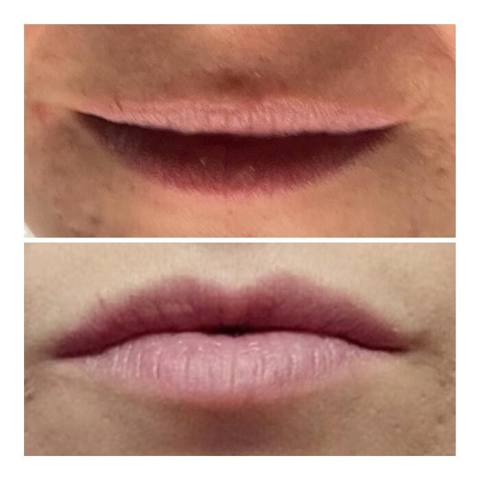 Images Radiance Esthetics & Med Spa