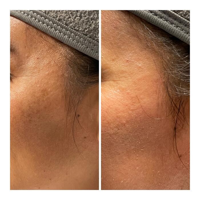 Images Radiance Esthetics & Med Spa