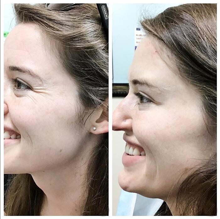 Images dermani MEDSPA North Buckhead Chastain