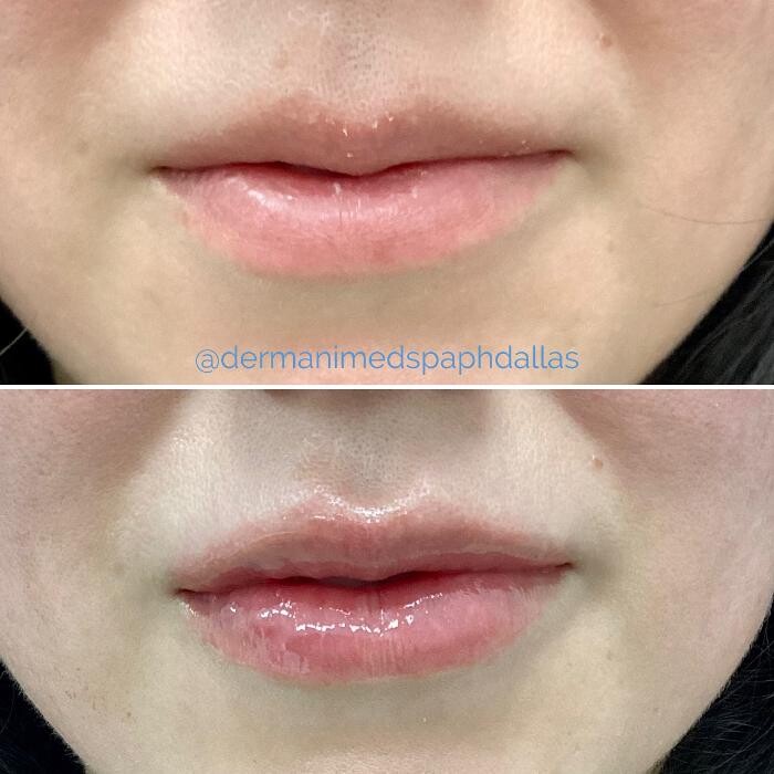 Images dermani MEDSPA Dallas (Preston Hollow)