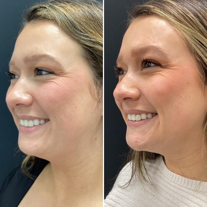 Images dermani MEDSPA Dallas (Preston Hollow)