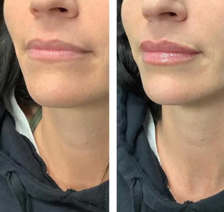 Images dermani MEDSPA Dallas (Preston Hollow)