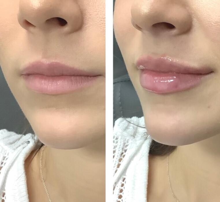 Images dermani MEDSPA Dallas (Preston Hollow)