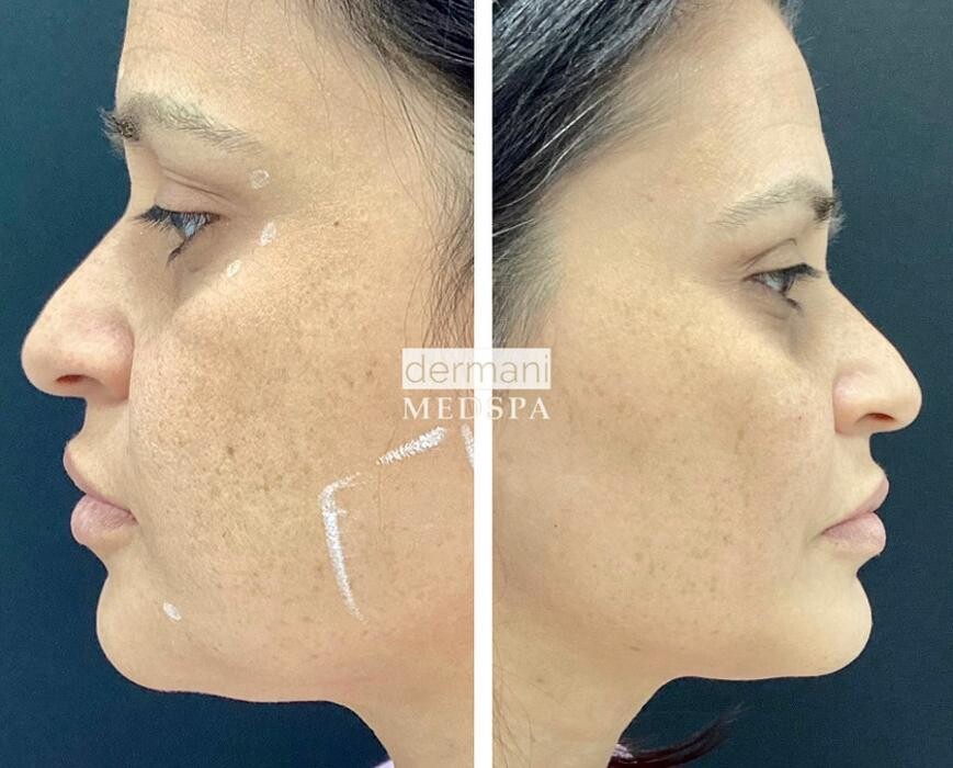 Images dermani MEDSPA Dallas (Preston Hollow)