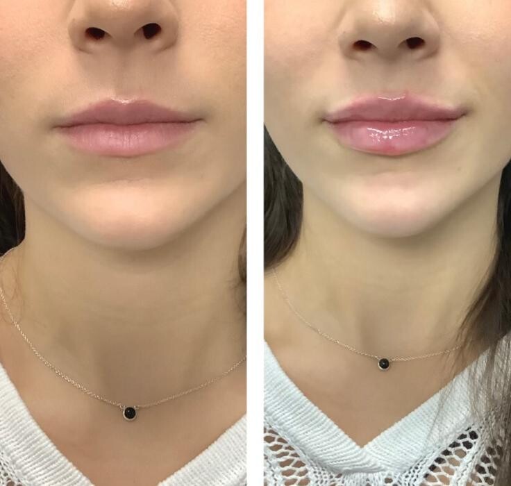 Images dermani MEDSPA Dallas (Preston Hollow)