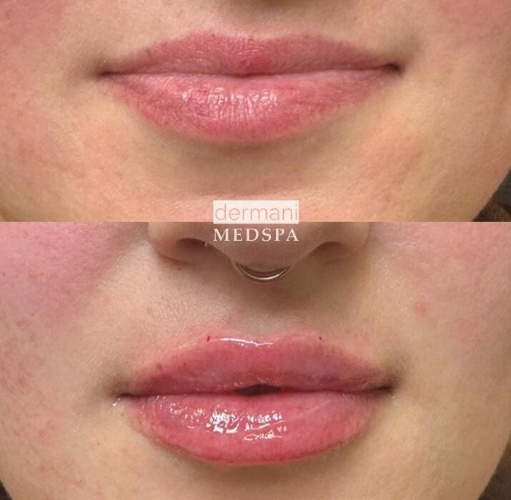 Images dermani MEDSPA Dallas (Preston Hollow)