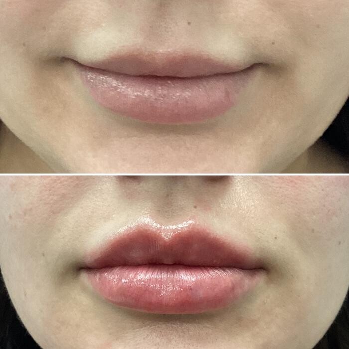 Images dermani MEDSPA Dallas (Preston Hollow)