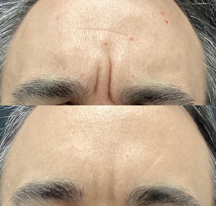 Images dermani MEDSPA Dallas (Preston Hollow)