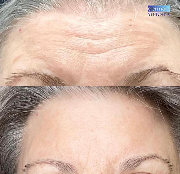 Images dermani MEDSPA Dallas (Preston Hollow)