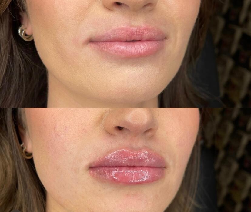 Images dermani MEDSPA Dallas (Preston Hollow)