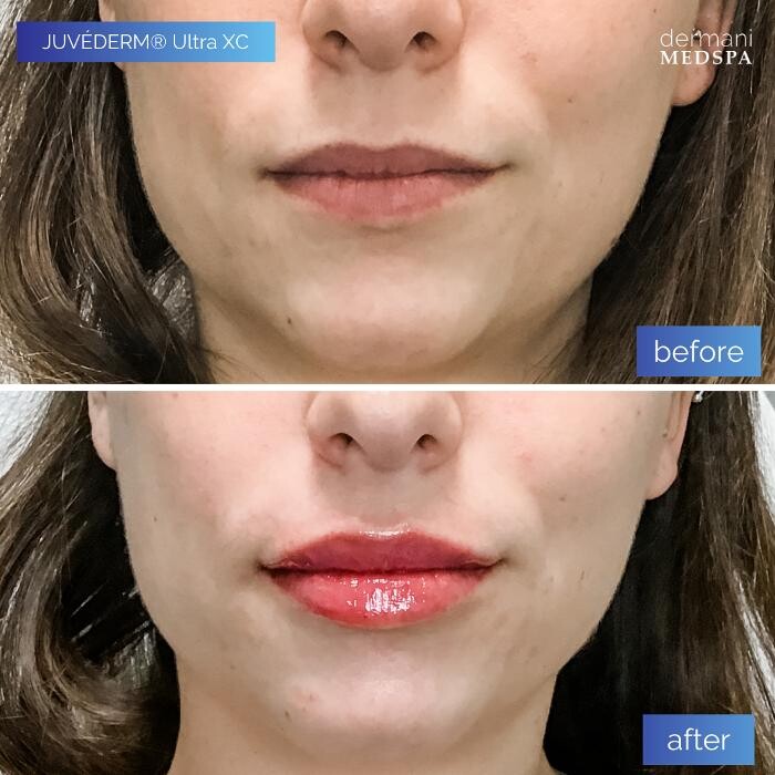 Images dermani MEDSPA Johns Creek