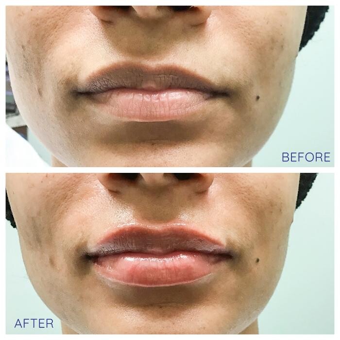 Images dermani MEDSPA Johns Creek