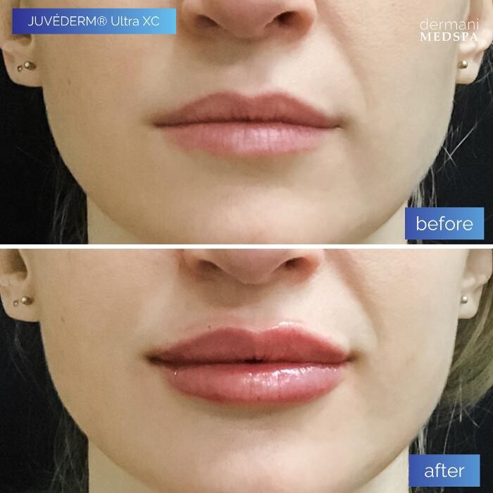 Images dermani MEDSPA Johns Creek