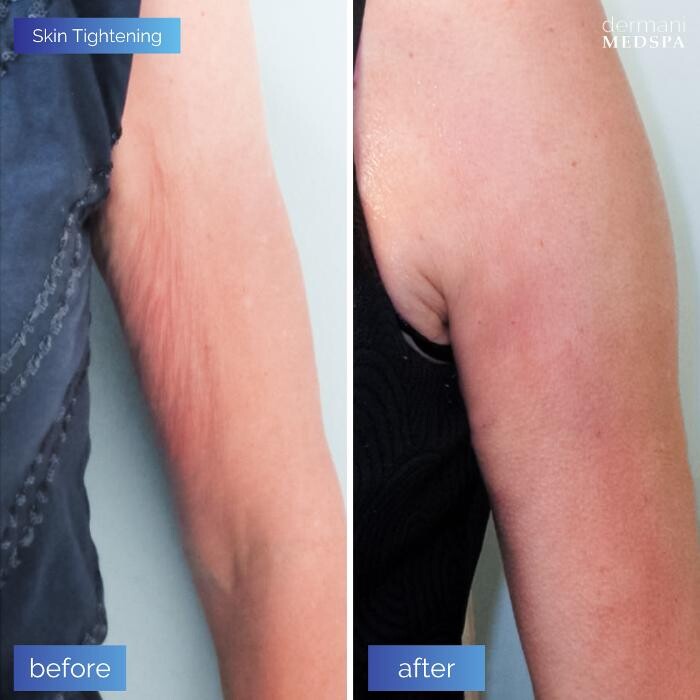 Images dermani MEDSPA Johns Creek