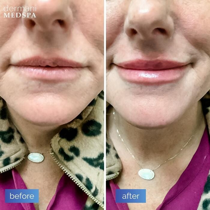 Images dermani MEDSPA Johns Creek