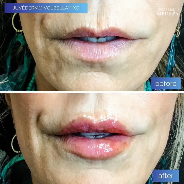 Images dermani MEDSPA Johns Creek