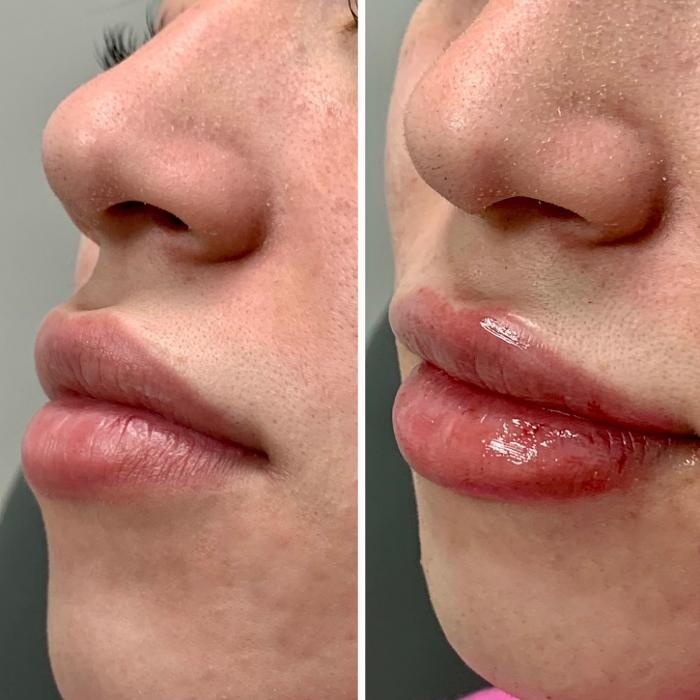 Images dermani MEDSPA Johns Creek