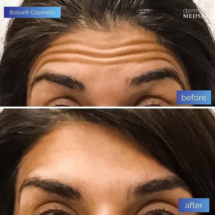 Images dermani MEDSPA Johns Creek