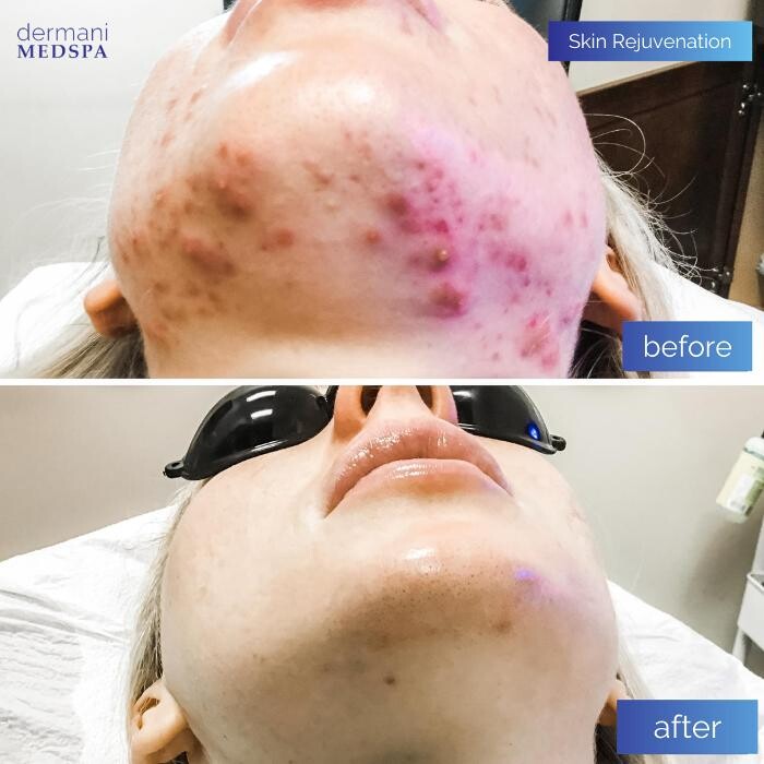 Images dermani MEDSPA Johns Creek