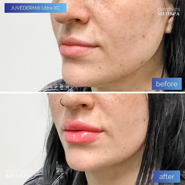 Images dermani MEDSPA