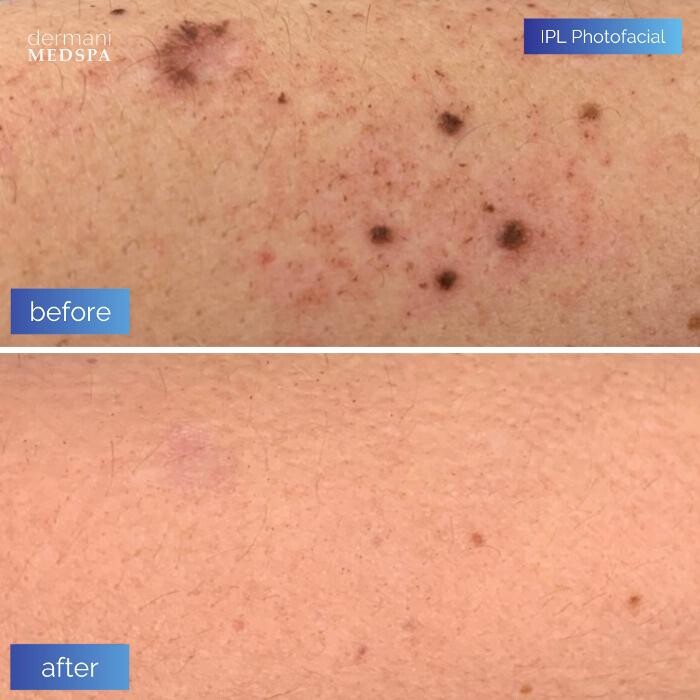 Images dermani MEDSPA