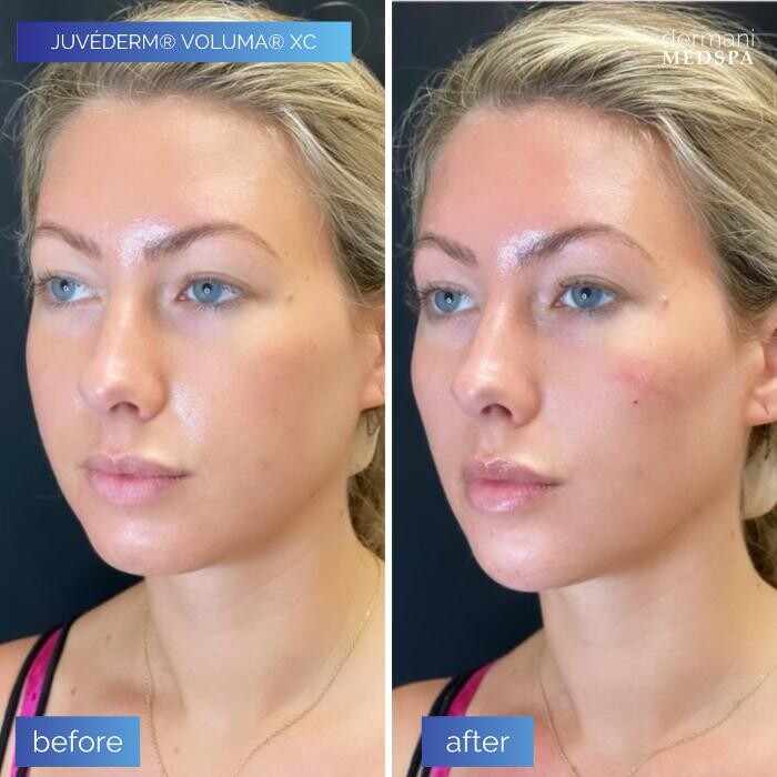 Images dermani MEDSPA Vinings