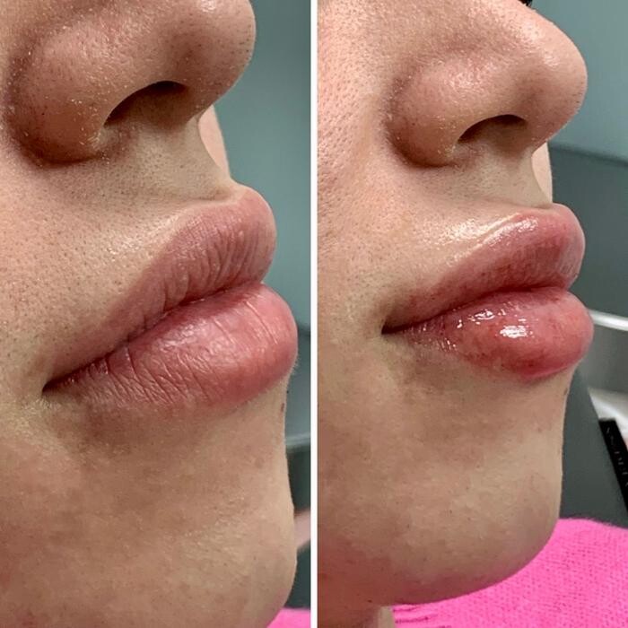 Images dermani MEDSPA Vinings