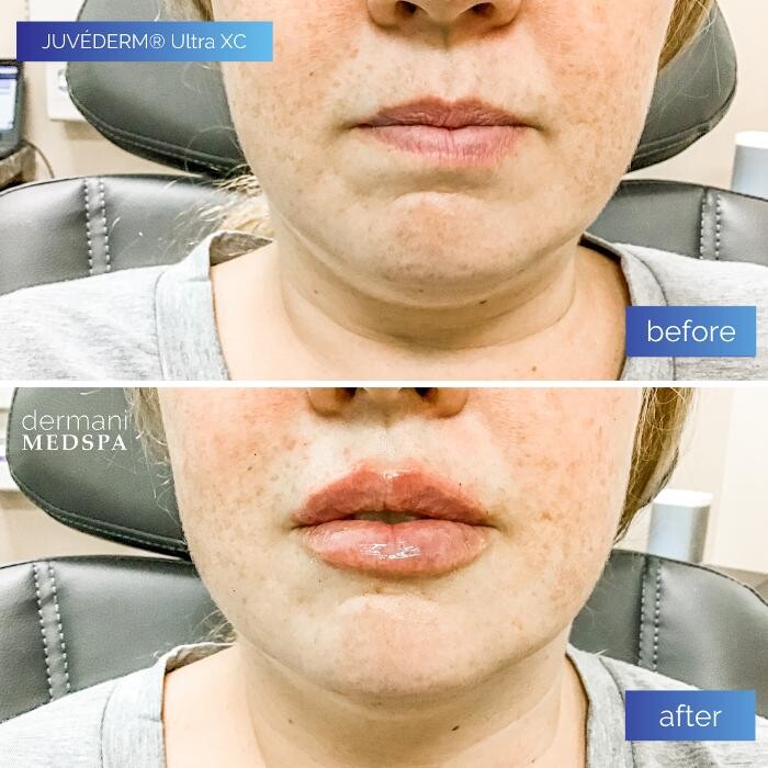 Images dermani MEDSPA Vinings