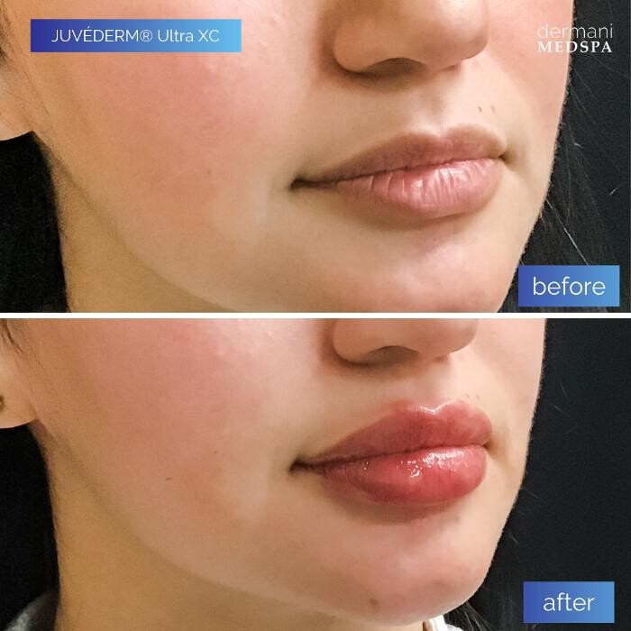 Images dermani MEDSPA Vinings