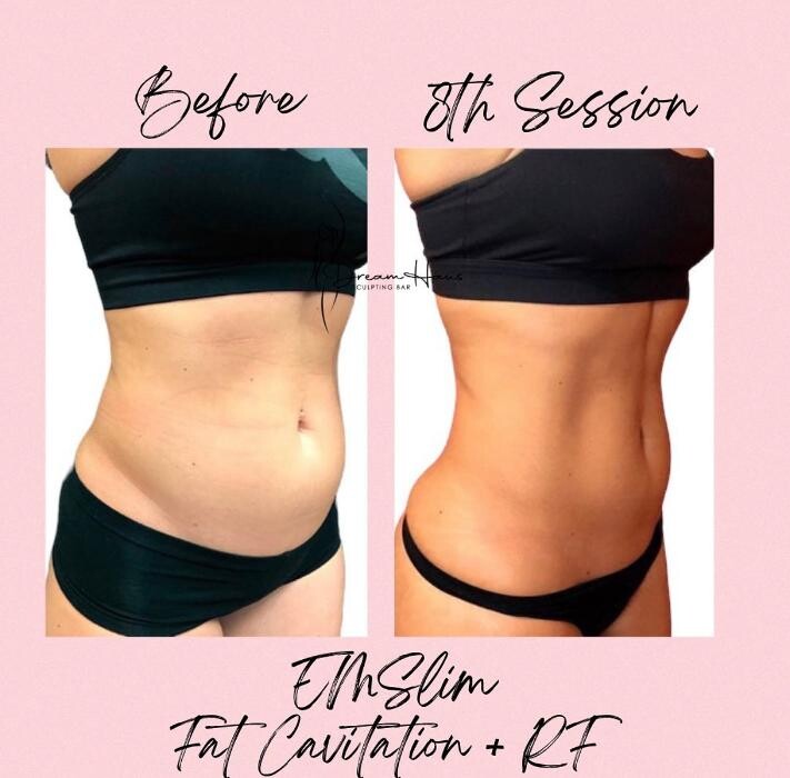 Images Dream Haus Sculpting Bar LLC