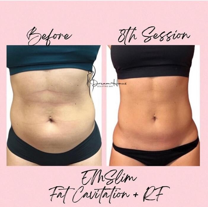 Images Dream Haus Sculpting Bar LLC