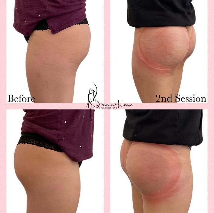 Images Dream Haus Sculpting Bar LLC