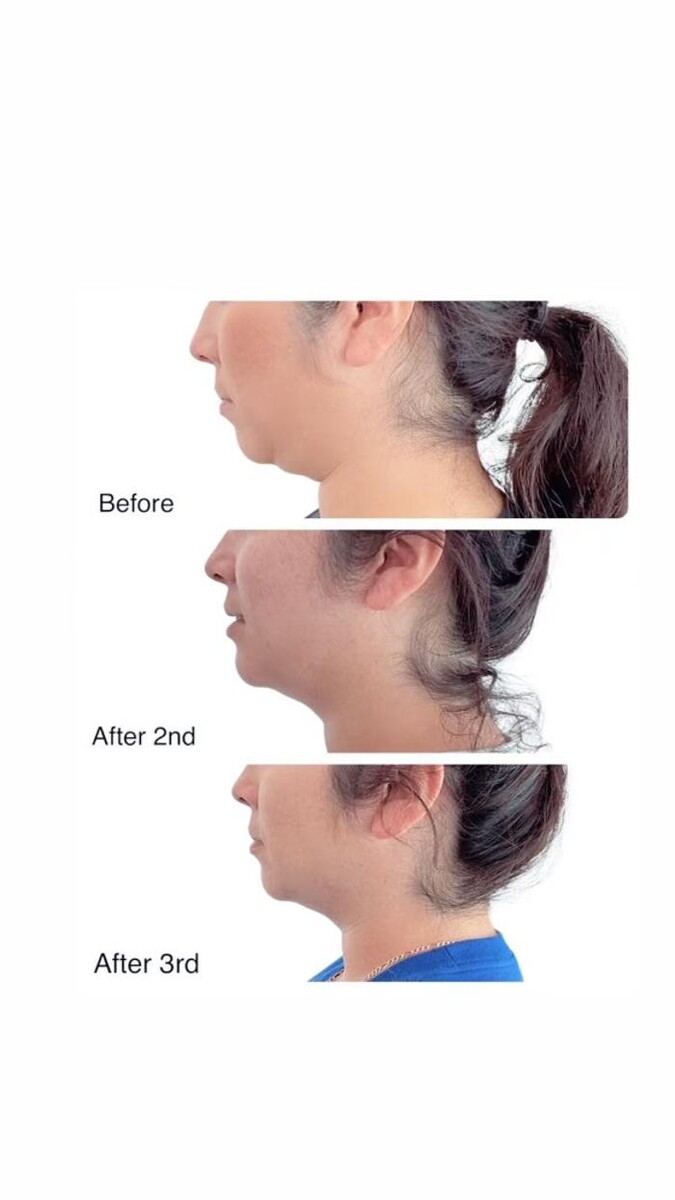 Images Dream Haus Sculpting Bar LLC