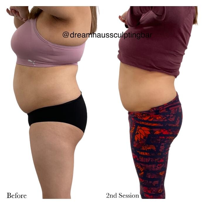 Images Dream Haus Sculpting Bar LLC