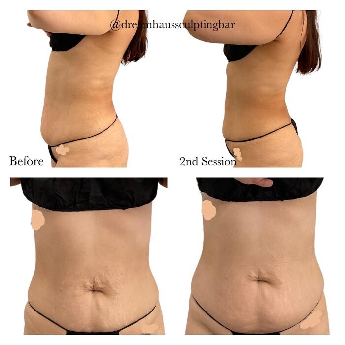 Images Dream Haus Sculpting Bar LLC