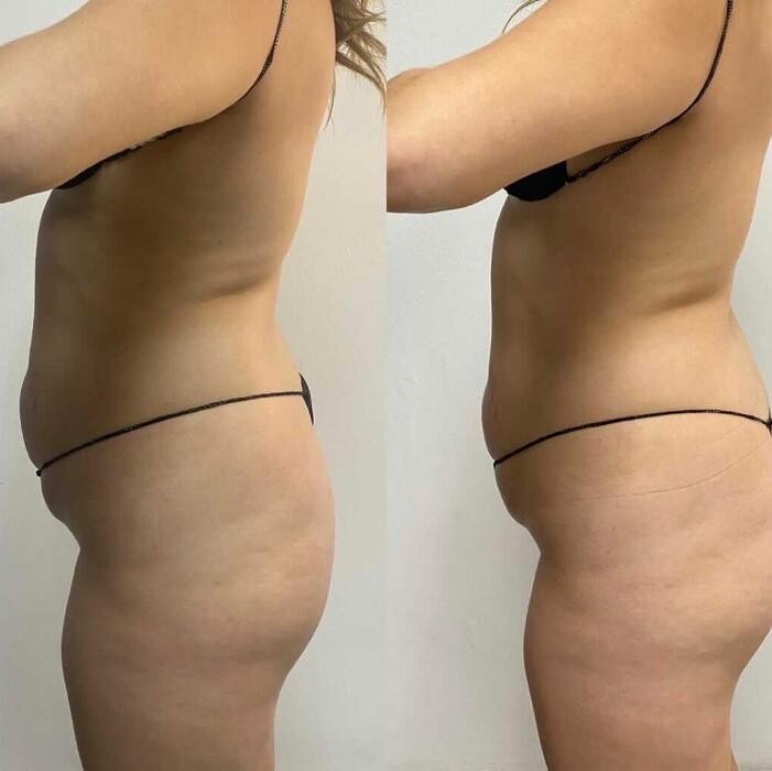 Images Dream Haus Sculpting Bar LLC