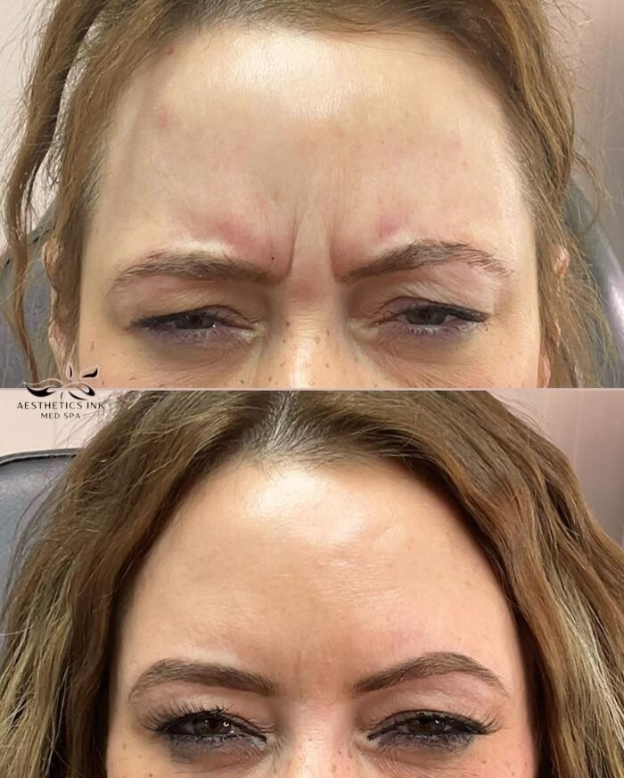 Images Aesthetics Ink Med Spa