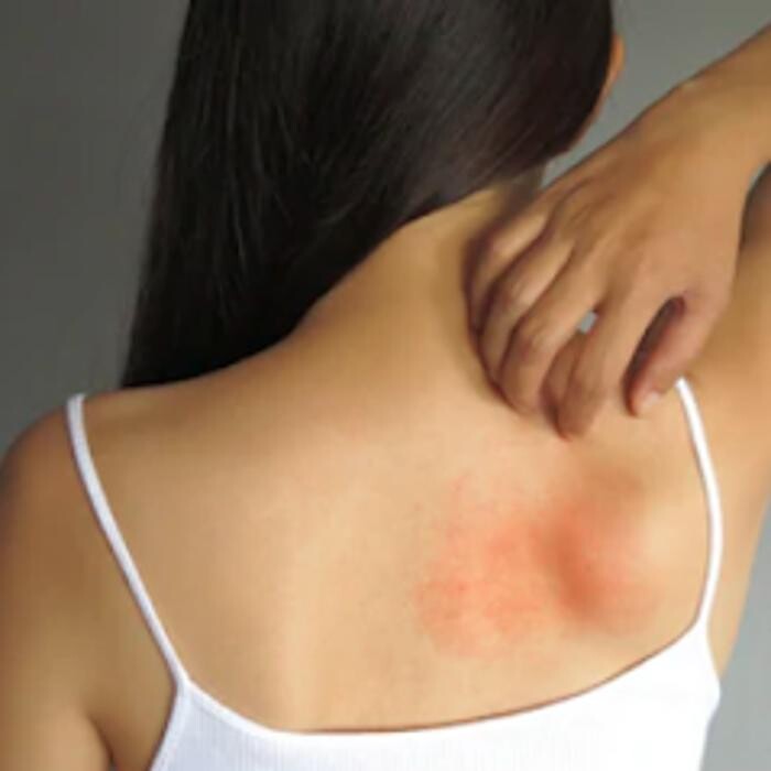 Images Asthma & Allergy Center: Dr. Anil Nanda, MD