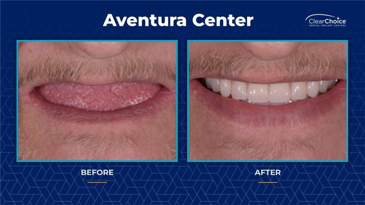 Images ClearChoice Dental Implant Center