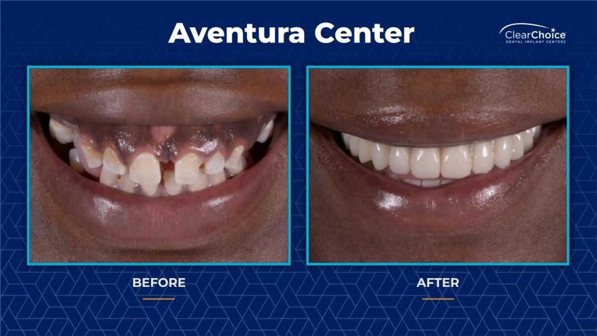 Images ClearChoice Dental Implant Center