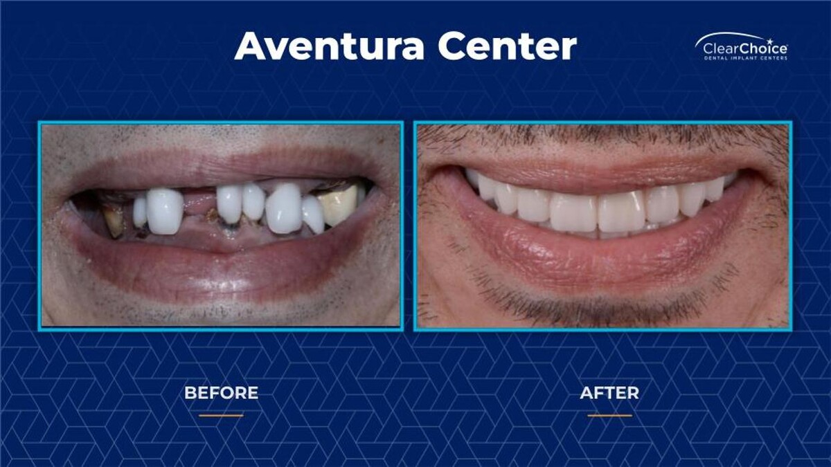 Images ClearChoice Dental Implant Center