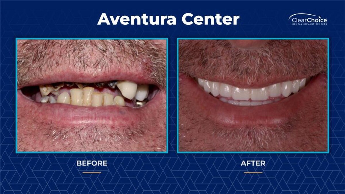 Images ClearChoice Dental Implant Center