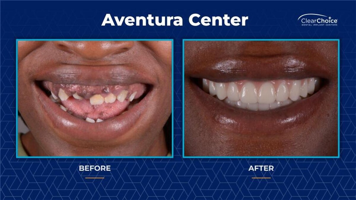 Images ClearChoice Dental Implant Center