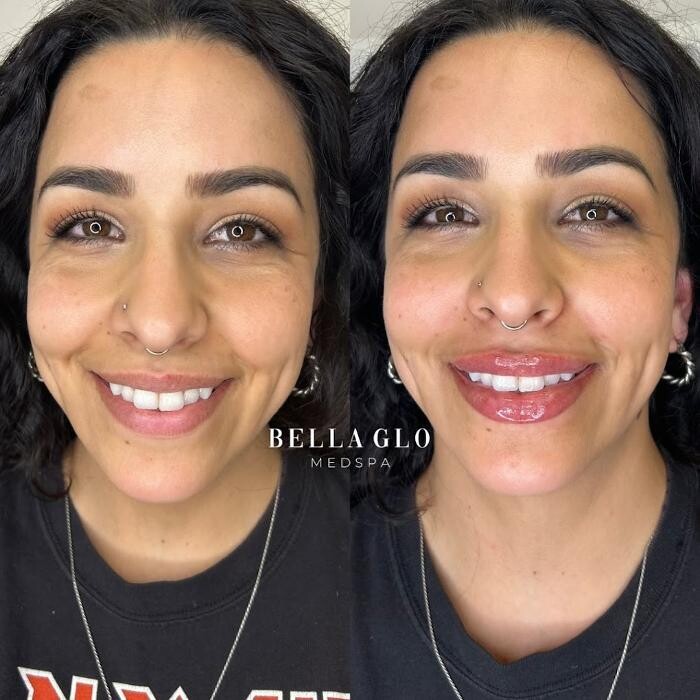 Images Bella Glo Medical Aesthetics & Wellness