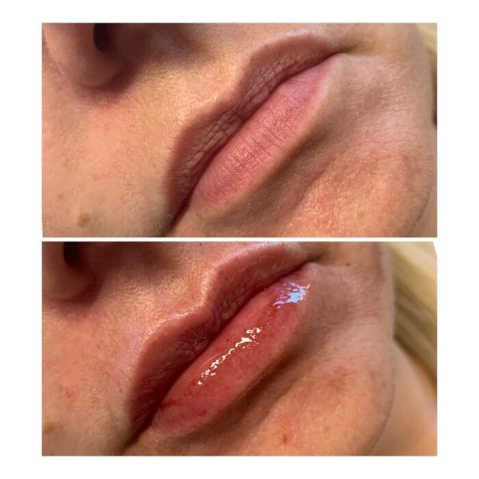 Images Bella Glo Medical Aesthetics & Wellness