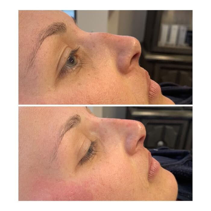 Images Bella Glo Medical Aesthetics & Wellness