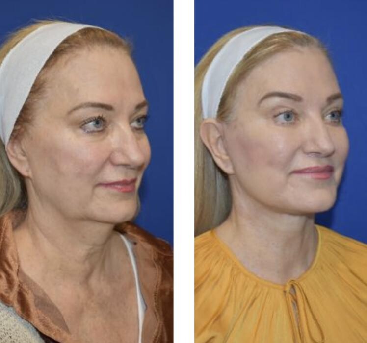 Images Facial Plastic Surgery of Austin