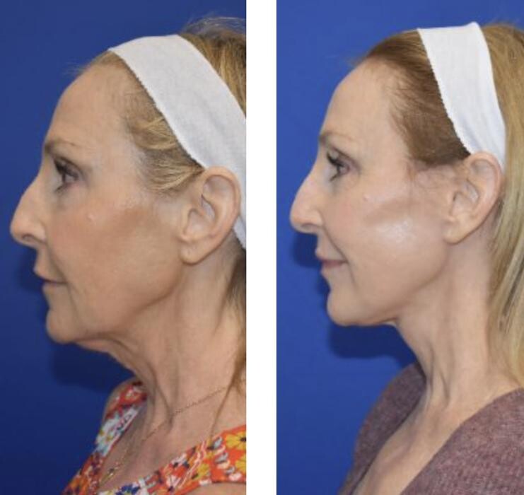 Images Facial Plastic Surgery of Austin