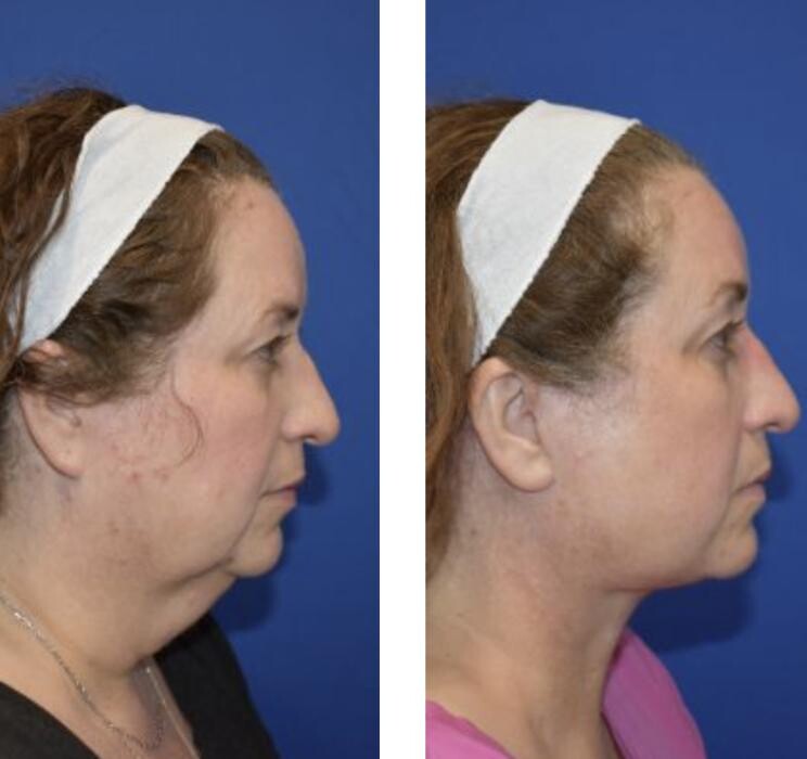 Images Facial Plastic Surgery of Austin